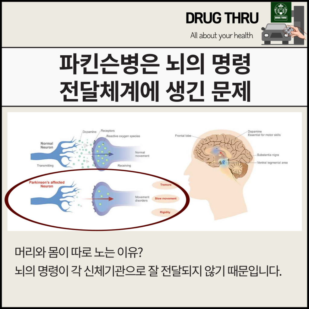 파킨슨병의원인과 도파민