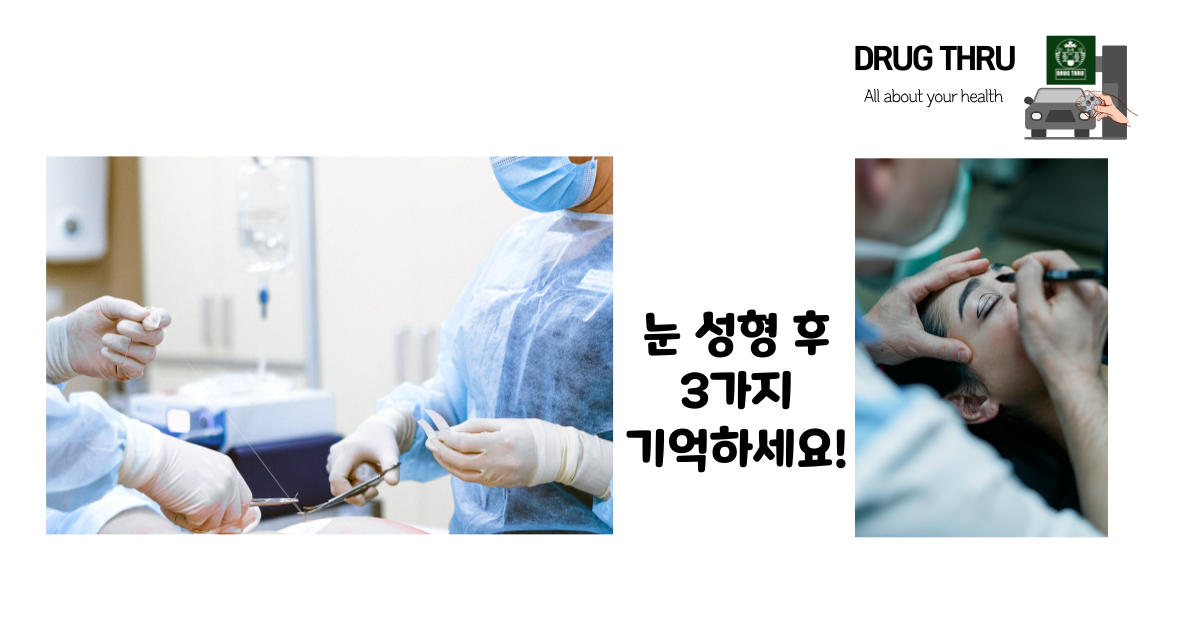 눈 성형 후 주의할 점