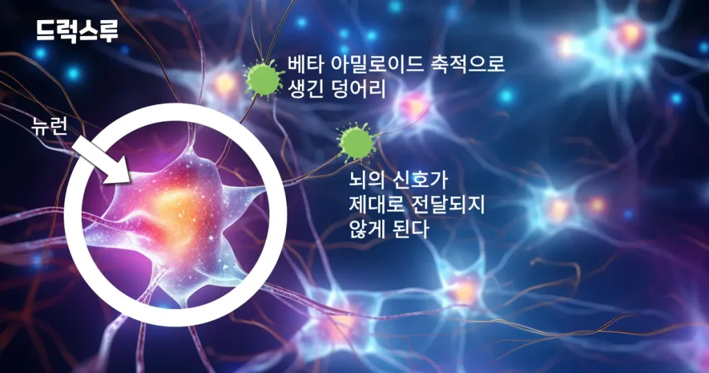 뉴런-신호전달-아밀로이드베타-치매원인