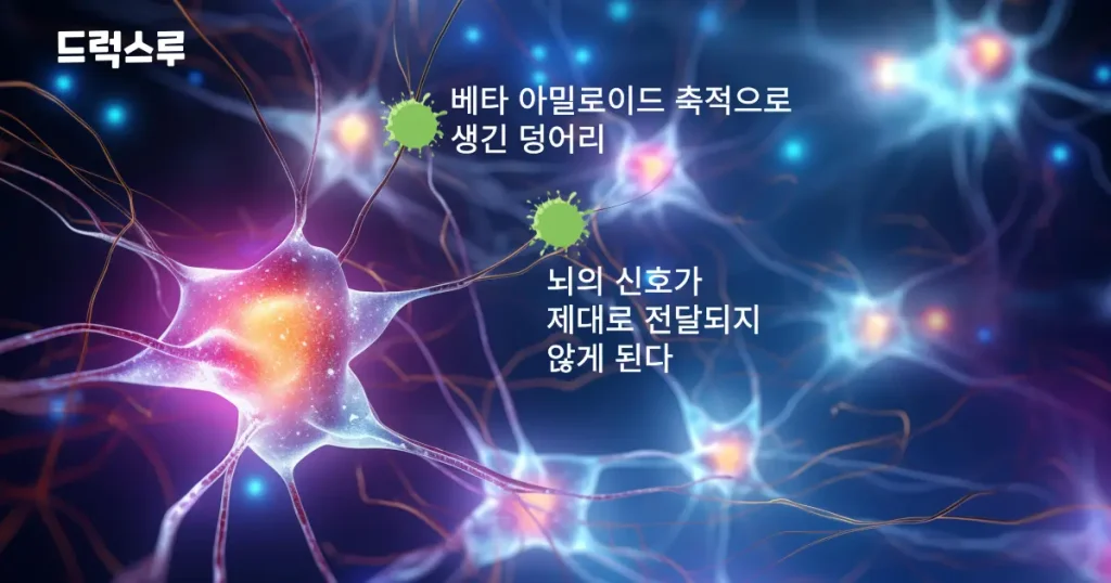 뉴런을 막는 아밀로이드 베타