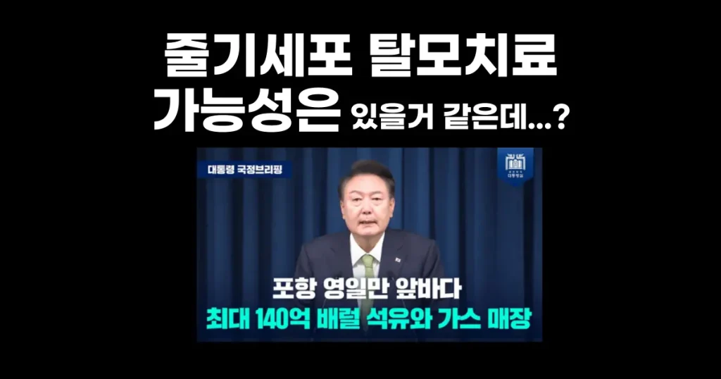 줄기세포 탈모치료-연구단계-치료효과