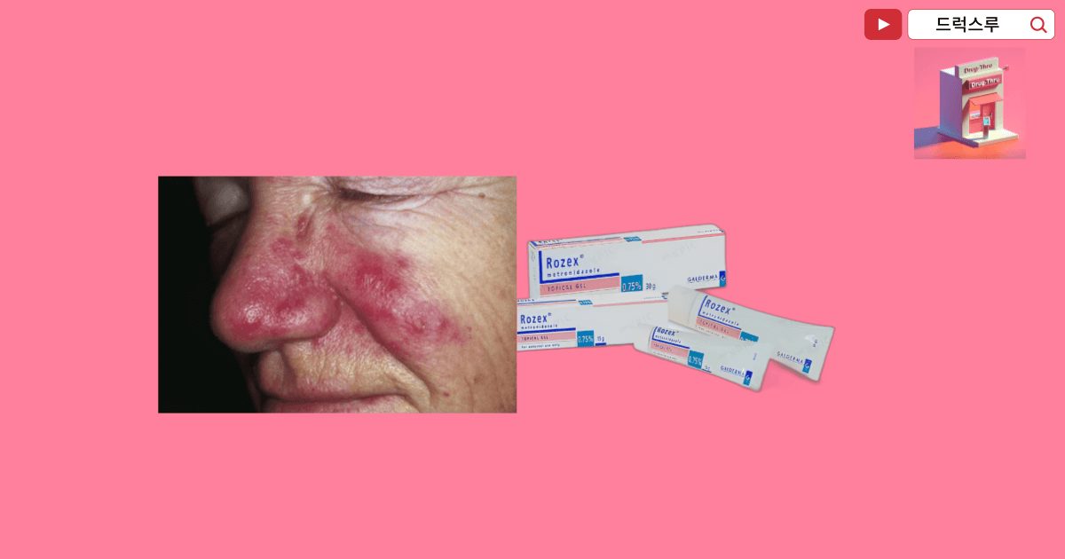 주사피부염-로섹스겔