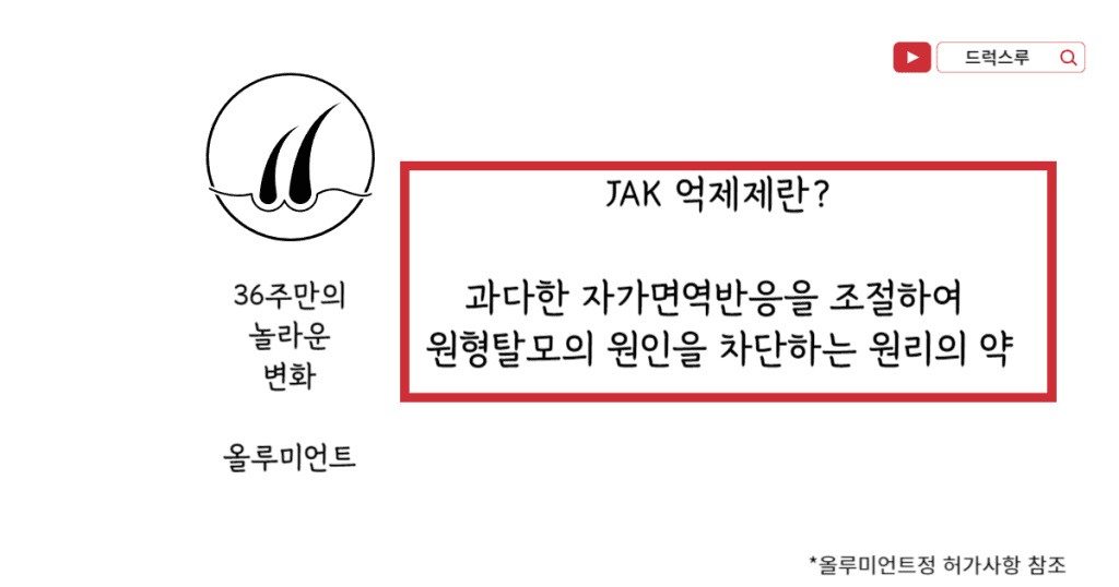 원형탈모-최신-치료제-올루미언트정