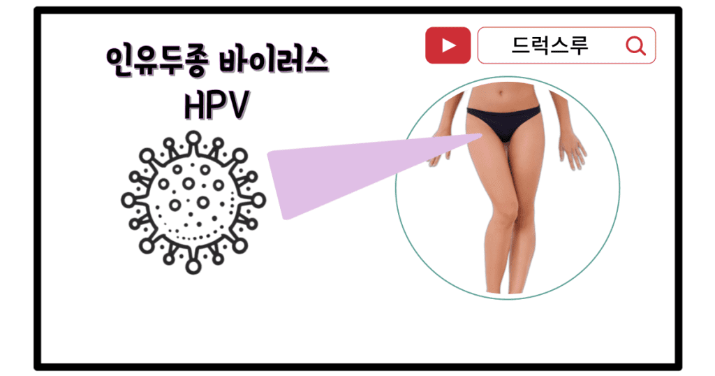 알다라크림-사마귀-인유두종바이러스