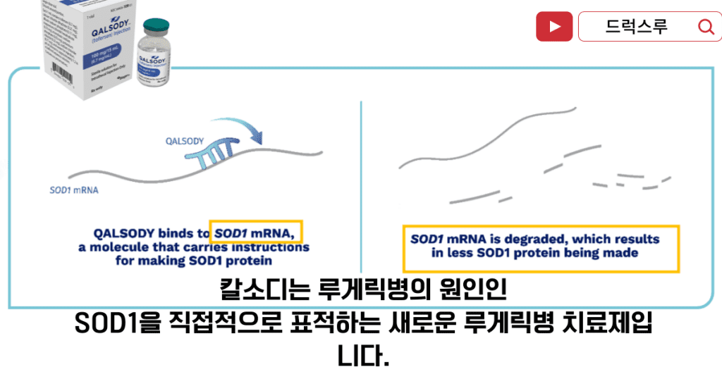 루게릭병-치료제-칼소디치료원리-SOD1