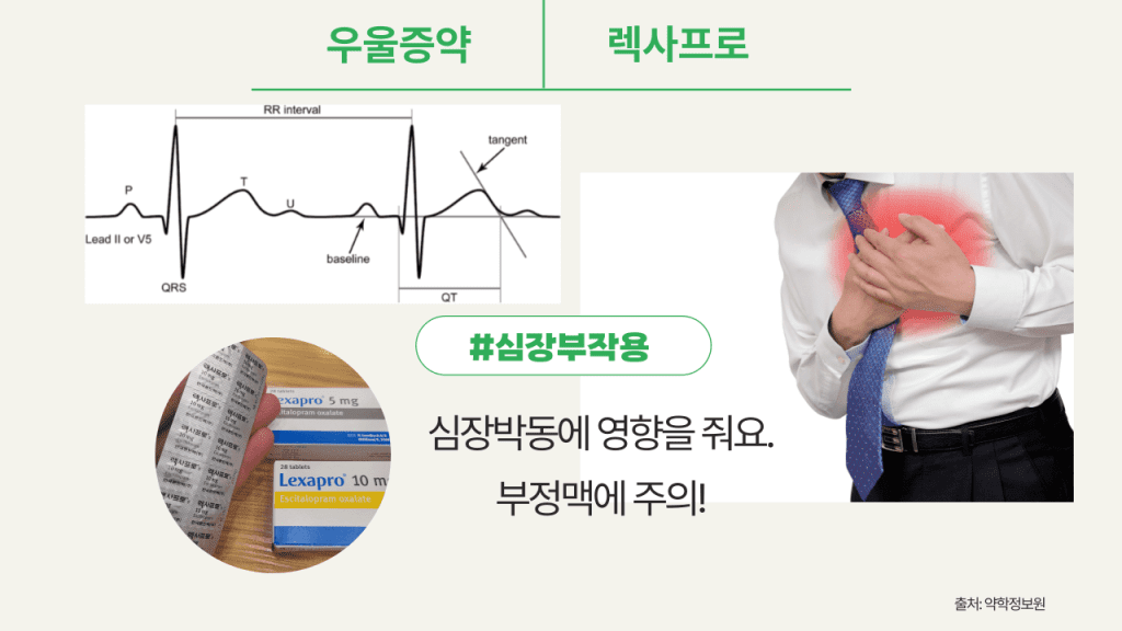 우울증약_렉사프로_심장부정맥_부작용