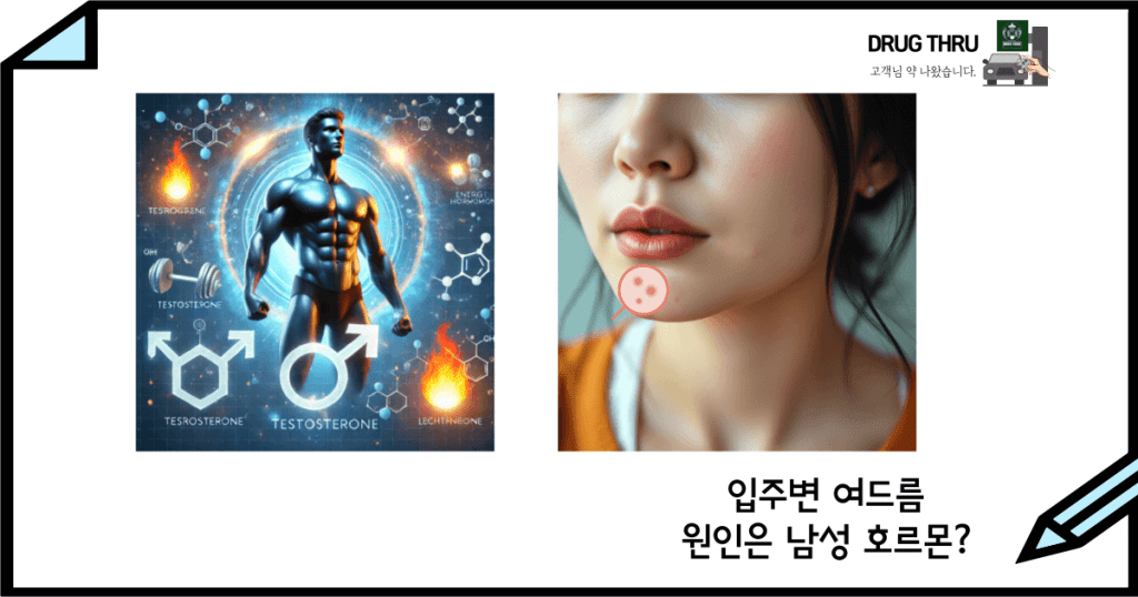 입주변 여드름_호르몬_안드로겐