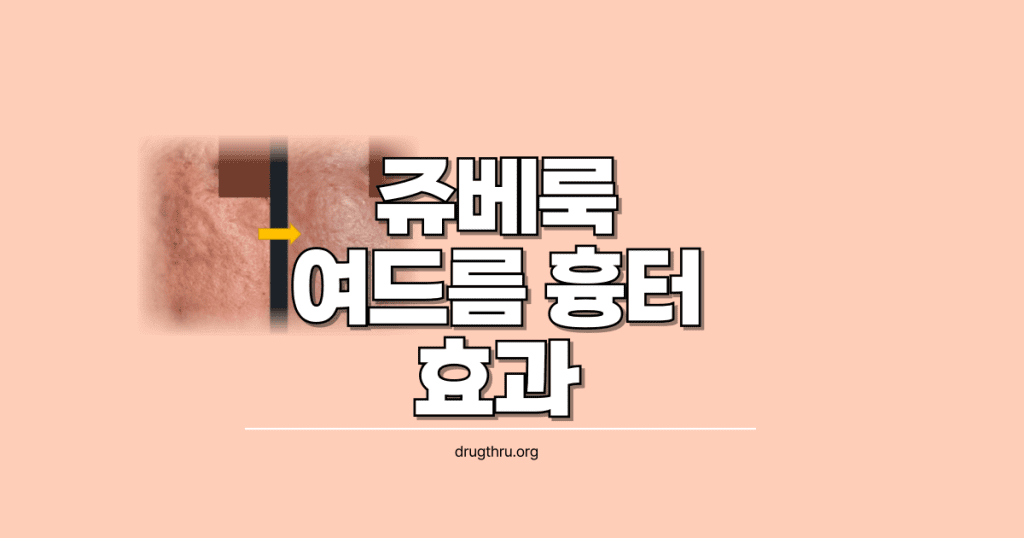 쥬베룩-여드름-흉터-효과