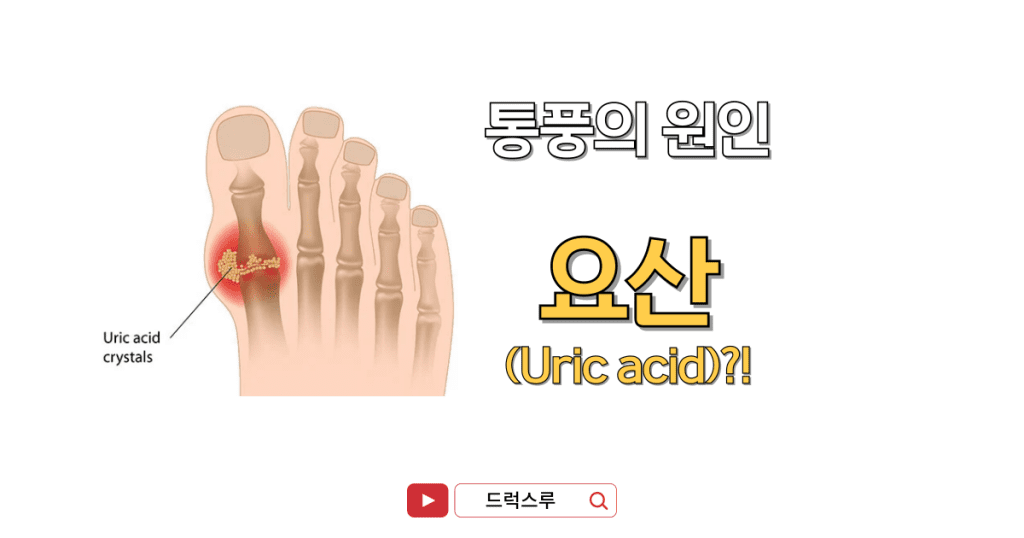 통풍-원인-요산-자이로릭