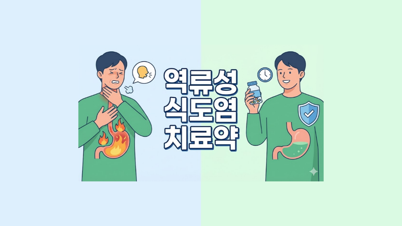 역류성식도염치료약-증상-종류-성분-복용팁
